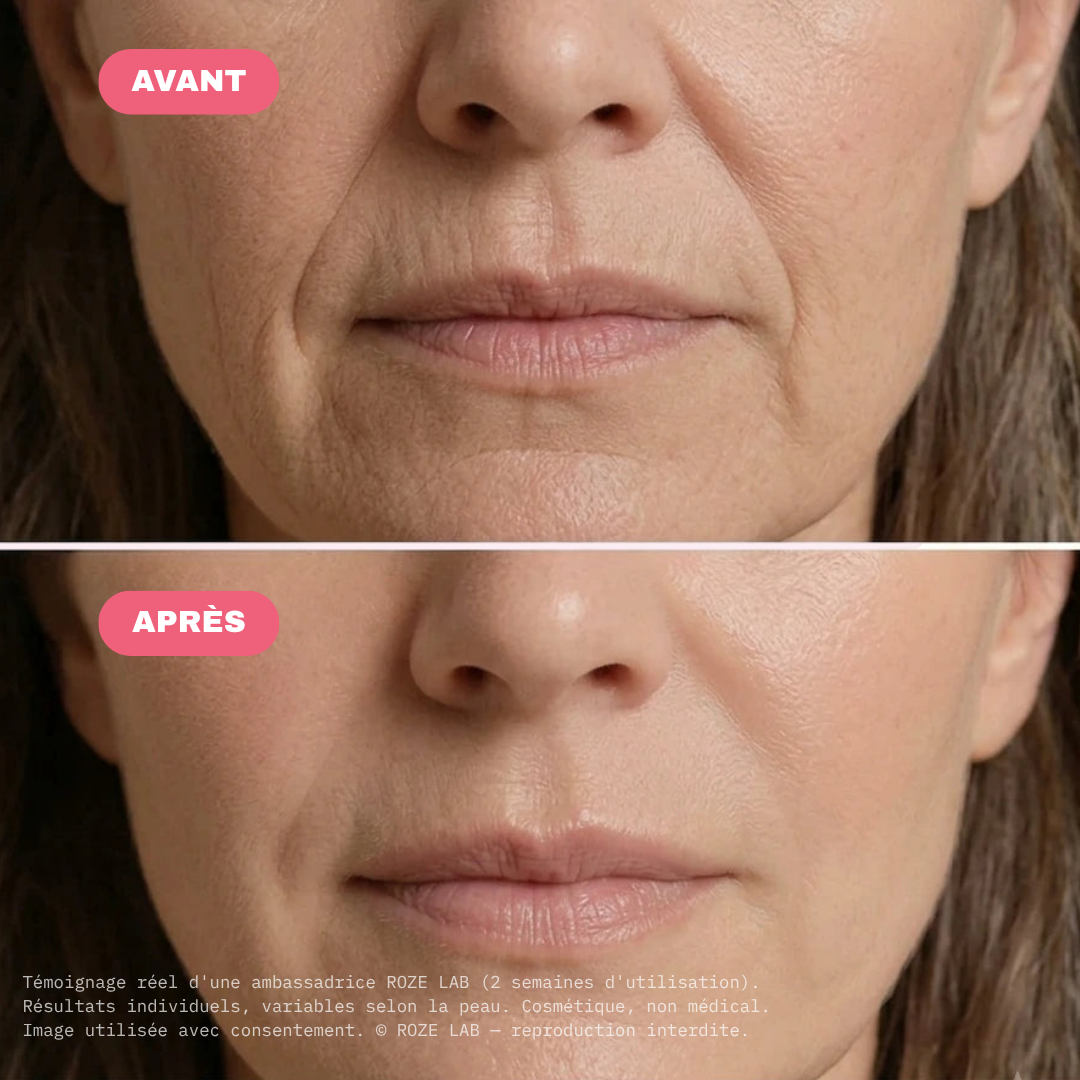 PDRN Pink Collagen Volume Multi Balm